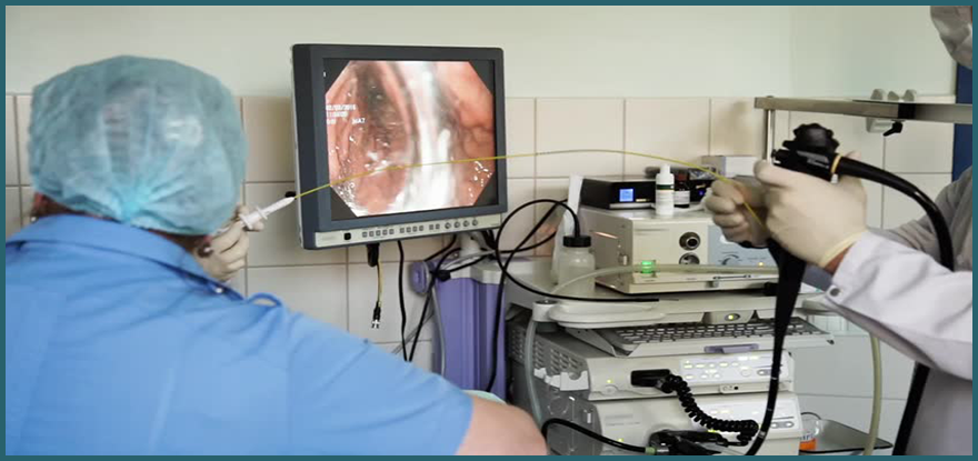 Video-Endoscopy